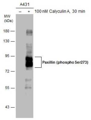 Western Blot: Paxillin [p Ser273] Antibody [NBP3-13099] - Untreated (-) and treated (+) A431 whole cell extracts (30 ug) were separated by 7.5% SDS-PAGE, and the membrane was blotted with Paxillin (phospho Ser273) antibody (NBP3-13099) diluted at 1:3000. The HRP-conjugated anti-rabbit IgG antibody (NBP2-19301) was used to detect the primary antibody.